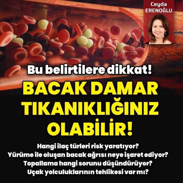 Bacak damar tıkanıklığınız olabileceğini gösteren belirtiler ve çözüm yolları