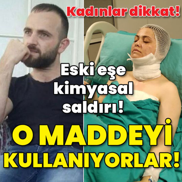 Eski eşe kimyasal saldırı O maddeyi kullanıyorlar