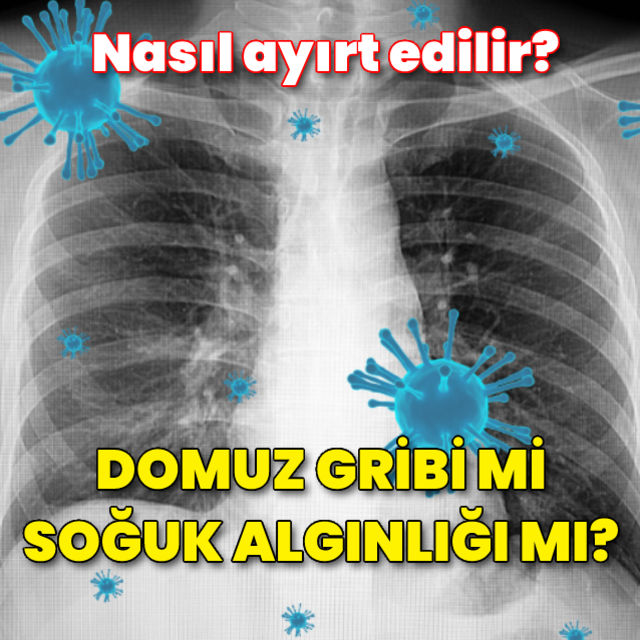 Domuz gribi ile soğuk algınlığı nasıl ayırt edilir